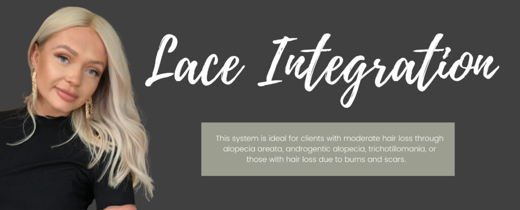 Lace Integration System